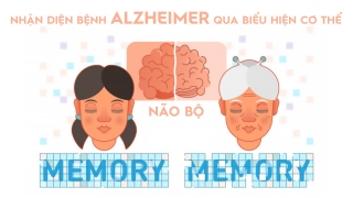 Nhận diện bệnh Alzheimer qua biểu hiện cơ thể